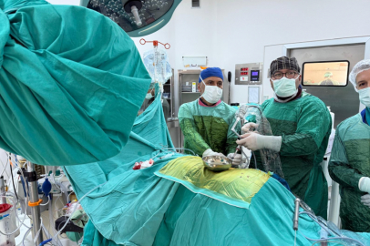 Malatya'da İri Böbrek Taşı Kapalı Yöntemle Çıkarıldı